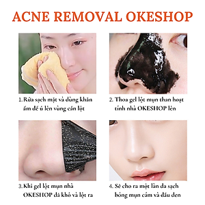 Gel Lột Mụn Than Tre Hoạt Tính OKESHOP 30ml - Giải Pháp Loại Bỏ Mụn Đầu Đen - Mụn Cám - Bạ Nhờn - Làm Sạch Sâu Và Thu Nhỏ Lỗ Chân Lông