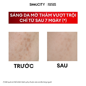 Bộ sản phẩm Men Stay Simplicity sáng da, mờ thâm cho nam: Sữa rửa mặt 100g + Vital Serum sáng da 30ml + Kem dưỡng ẩm 80g