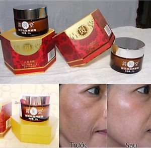 HỘP KEM TRỊ HẾT NÁM TÀN NHANG TỪ NHẬT BẢN CAO CẤP CHO MỌI NGƯỜI