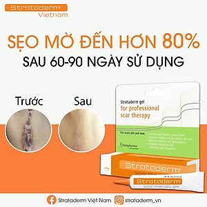 Strataderm 10g - Gel Silicone ngăn ngừa sẹo xấu