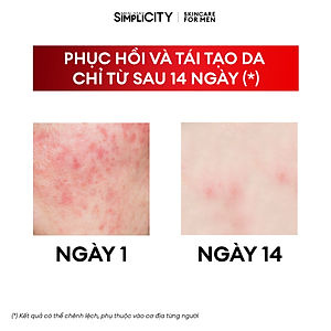 Bộ sản phẩm chăm sóc Men Stay Simplicity phục hồi & cân bằng da cho nam Recovery Trio: 01 Sữa rửa mặt 100g x Seurm 30ml x Kem dưỡng ẩm 80g