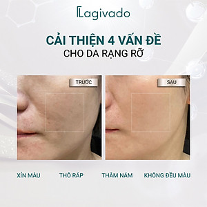 Kem dưỡng trắng da, mờ thâm nám, đốm nâu Lagivado High-L Revital Cream với Arbutin 2% - 10 g