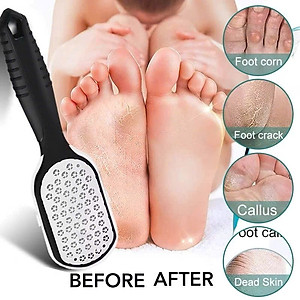 Cây Chà Gót Chân Bản To, Tẩy Da Chết 2 Mặt Bằng Thép, Kèm Hộp Đựng Tiện Lợi - HÀNG CHÍNH HÃNG MINIIN