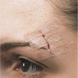 Set 3 vỉ 30 miếng dán thay chỉ khâu da 3M Steri-strip™ R1546 – Size 6mm x 100mm | Sản xuất tại Mỹ