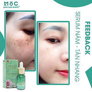 Serum Ngừa Nám - Tàn Nhang 10ml - Mộc