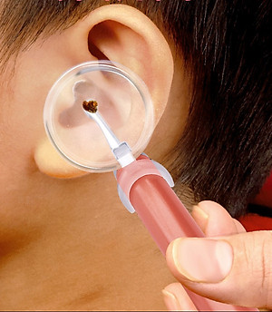 Dụng Cụ Lấy Ráy Tai Chuyên Nghiệp, Ngoáy Tai Có Đèn Cho Bé - HBH