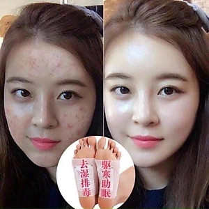 Hộp 50 Miếng Dán Ngải Cứu Thải Độc Chân Lão Bắc Kinh(Lao Beijing)