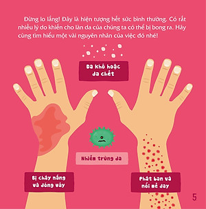 Sách Có Thể Bạn Chưa Biết- Vì Sao Chúng Ta... Bị Bong Da?