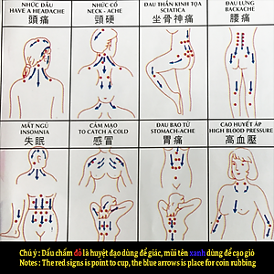 Bộ 24 ly giác hơi không dùng lửa Duy Thành YGH0324