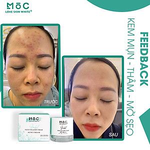 KEM NGỪA MỤN THÂM - MỜ SẸO - COLLAGEN /20G - MỘC