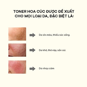 Bộ Đôi Zakka Naturals Sữa Dưỡng Cúc 150ml và SRM Cúc 185g Làm Sạch Và Cấp Ẩm Dịu Nhẹ Cho Da Nhạy Cảm