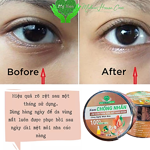 KEM CHỐNG NHĂN, LÀM GIẢM THÂM VÙNG MẮT HẠNH NHÂN MẸ KEN