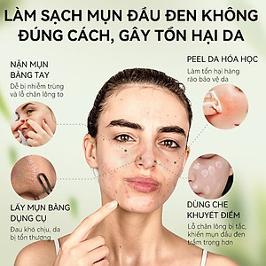 Gel Lột Mụn Nha Đam OKESHOP 30ml - Giải Pháp Loại Bỏ Mụn Đầu Đen - Mụn Cám - Bạ Nhờn - Làm Sạch Sâu Và Thu Nhỏ Lỗ Chân Lông