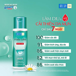 Dung dịch dưỡng ẩm Hada Labo Acne Care Calming Lotion dành cho da dầu mụn, da nhạy cảm 170ml