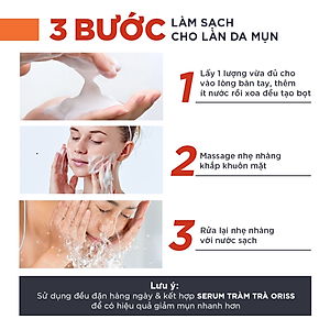 Sữa Rửa Mặt Tạo Bọt Ngừa Mụn Oriss 100g - Chuyên Dành Cho Da Mụn