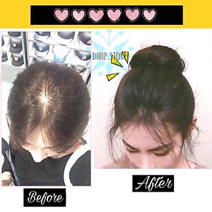 Tóc kẹp phồng đơn - Tóc giả che mái hói cao cấp