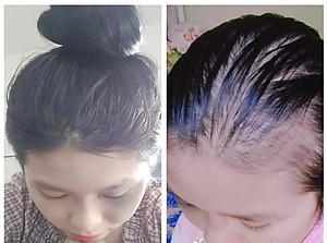 TINH CHẤT GỘI ĐẦU THẢO MỘC MẸ KEN-Chai 250ml