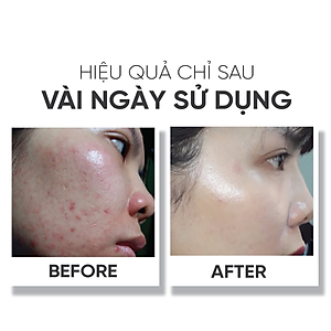Serum giúp dưỡng trắng da, làm mờ sẹo và se khít lỗ chân lông Lá House Scars Therapy Concentrated 15ml/30ml