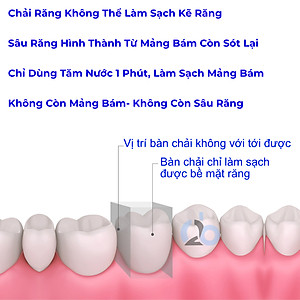 Tăm nước cầm tay H2ofloss HF-10, phiên bản tăm nước mini nhỏ gọn chỉ 14.5 cm dành cho người di chuyển nhiều