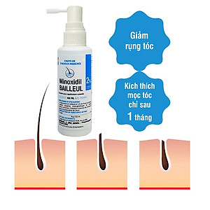 Set 3 lọ xịt mọc tóc Minoxidil Bailleul Pháp, 2%