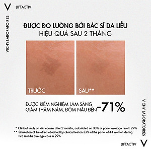 Tinh chất giúp cải thiện & ngăn ngừa thâm nám đốm nâu Vichy Liftactiv B3 dark spots 30ml