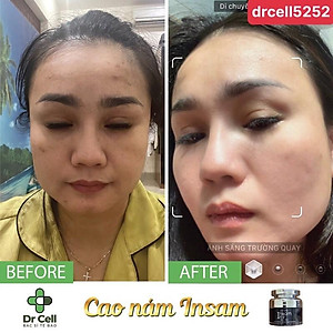 Cao Nám Insam DR CELL 20g hỗ trợ mờ thâm nám dưỡng trắng da la,2 đều màu da - Hàng Chính Hãng
