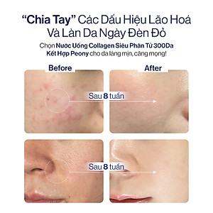 NƯỚC UỐNG COLLAGEN GILAA SIÊU PHÂN TỬ 300DA GILAA KẾT HỢP PEONY TRẺ HÓA CÂN BẰNG NỘI TIẾT (20g x 15 gói)