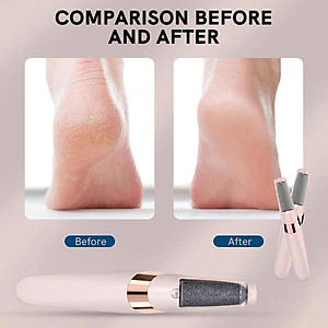 Máy Chà Gót Chân, Tẩy Tế Bào Chết Cho Tiệm Nail, Cá Nhân Tại Nhà Cao Cấp Sạc Tích Giảm Vết Chai Sạn Điện Làm Mịn Da
