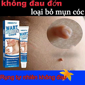 Serum Xóa Mụn Cóc, Mụn Thịt, Nốt Ruồi Hiệu Quả Cao – Thảo Dược Thiên Nhiên, Không Gây Sẹo đèn led