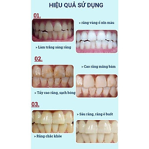 Kem Đánh Răng HUNMUI Siêu Hot