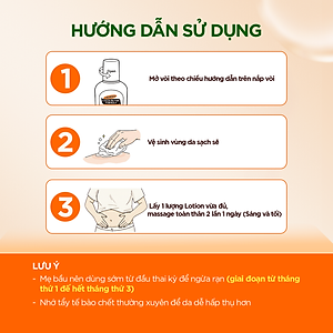 (Mini Size) Dưỡng thể ngừa rạn đầu thai kì 50ml