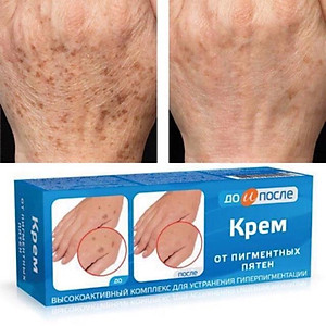 Kem chống đồi mồi Nga - Kem đồi mồi