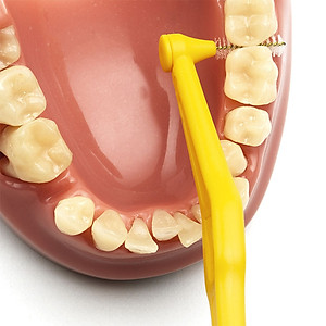 Bàn chải kẽ răng góc TePe Angle – đầu nhỏ, dễ chải kẽ răng sau (Vỉ 6 cây) - Nhập Khẩu Thuỵ Điển