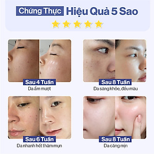 Bột Uống Collagen Gilaa Cao Cấp Kết Hợp Saffron - (60 gói x 2g)