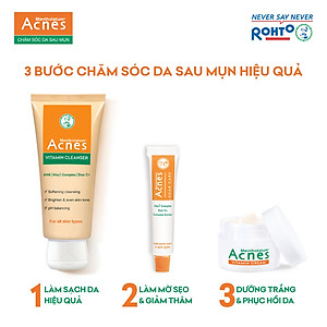 Sữa rửa mặt vitamin làm sáng da, mờ sẹo thâm dạng kem Acnes Vitamin Cleanser 100g