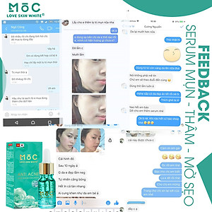 Serum Ngừa Mụn Thâm, Mờ Sẹo 10ml MỘC