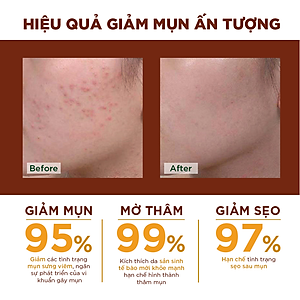 Kem Nghệ Giảm Mụn Oriss Giúp Mờ Thâm Sẹo Dưỡng Ẩm Sáng Da 20g