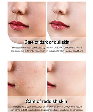 white glutathione tone up cream Frontiers
