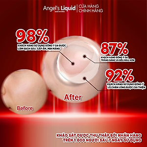 Nước Thần Dưỡng Trắng Da Cân Bằng Độ Ẩm Angel's Liquid Tone Up Whitening Program Glutathione Treatment Essence 150ml