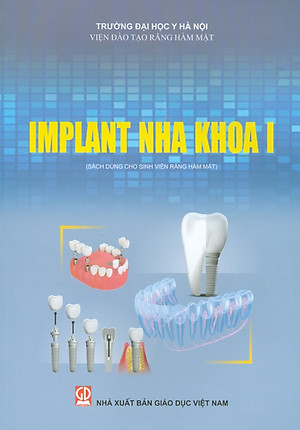 Implant Nha Khoa I