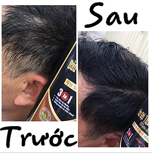 Dầu Gội Thảo Dược Đen Tóc SINORI 500 ml, Dầu Gội Phủ Bạc Nhuộm Tóc Cao Cấp Thiên Nhiên Chiết Suất Từ Nhân Sâm, Hà Thủ Ô, Ngũ Bội Tử, Trắc Bạch Diệp, Vừng Đen, Gừng