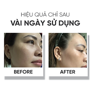 Nước hoa hồng cấp ẩm,cải thiện độ đàn hồi cho da LÁ HOUSE Toner Astalock 100ml/200ml