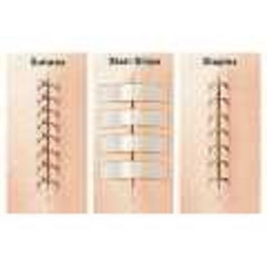 Set 3 vỉ 30 miếng dán thay chỉ khâu da 3M Steri-strip™ R1546 – Size 6mm x 100mm | Sản xuất tại Mỹ