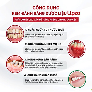 Combo 3 Kem Đánh Răng Lipzo Gum Protect Chống Tụt Nướu 185g Ngăn Ngừa Chảy Máu Chân Răng, Khử Khuẩn, Răng Chắc Khỏe