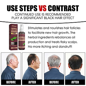 Tinh Chất Dầu Dưỡng Thảo Dược Xịt Đen Tóc Vĩnh Viễn – Giải Pháp Phục Hồi Tóc Bạc Tại Nhà Hiệu Quả