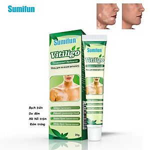 [Vilitigo] Chiết xuất thảo dược, Kem bôi lang ben, hắc lào, nấm ngứa, á sừng, vẩy nến loại tốt an toàn hiệu quả