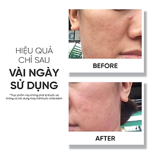 Collagen bổ sung Vitamin C tăng khả năng chống oxy hóa Lá House Pure Amino Collagen C+ (6.5g*30gói)