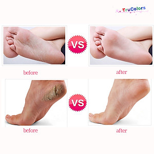 Máy chà gót chân, tẩy sạch da chết dùng cá nhân và tiệm nail, spa