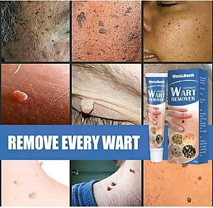 HỘP KEM BÔI TRỊ HẾT MỤN CÓC NÚT RUỒI DA ĐEN SẠM THUẬN TIỆN CHO MỌI NGƯỜI