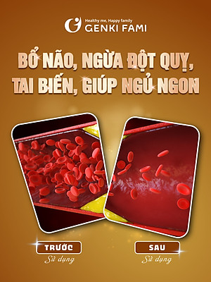 Viên Uống Phòng Ngừa Đột Quỵ, Bổ Não Nattokinase 3000FU Natto Ichou Genki Fami Nhật Bản